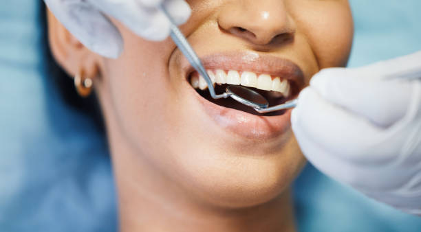 Best Lost Filling or Crown Replacement in Chinle, AZ